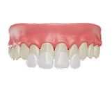 Faccette Dentali